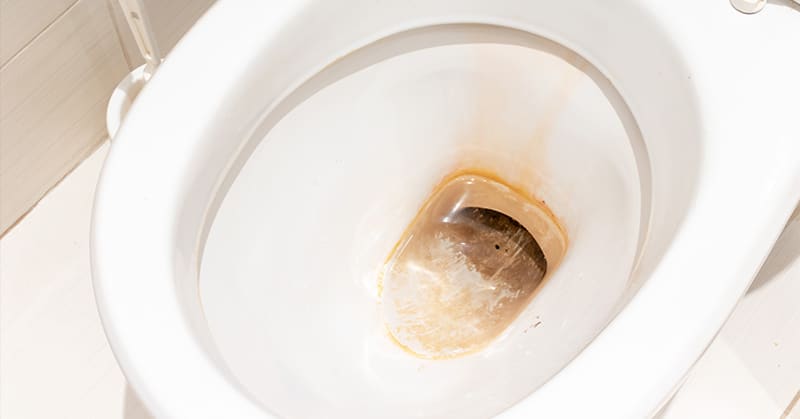 What Causes the Toilet Ring?